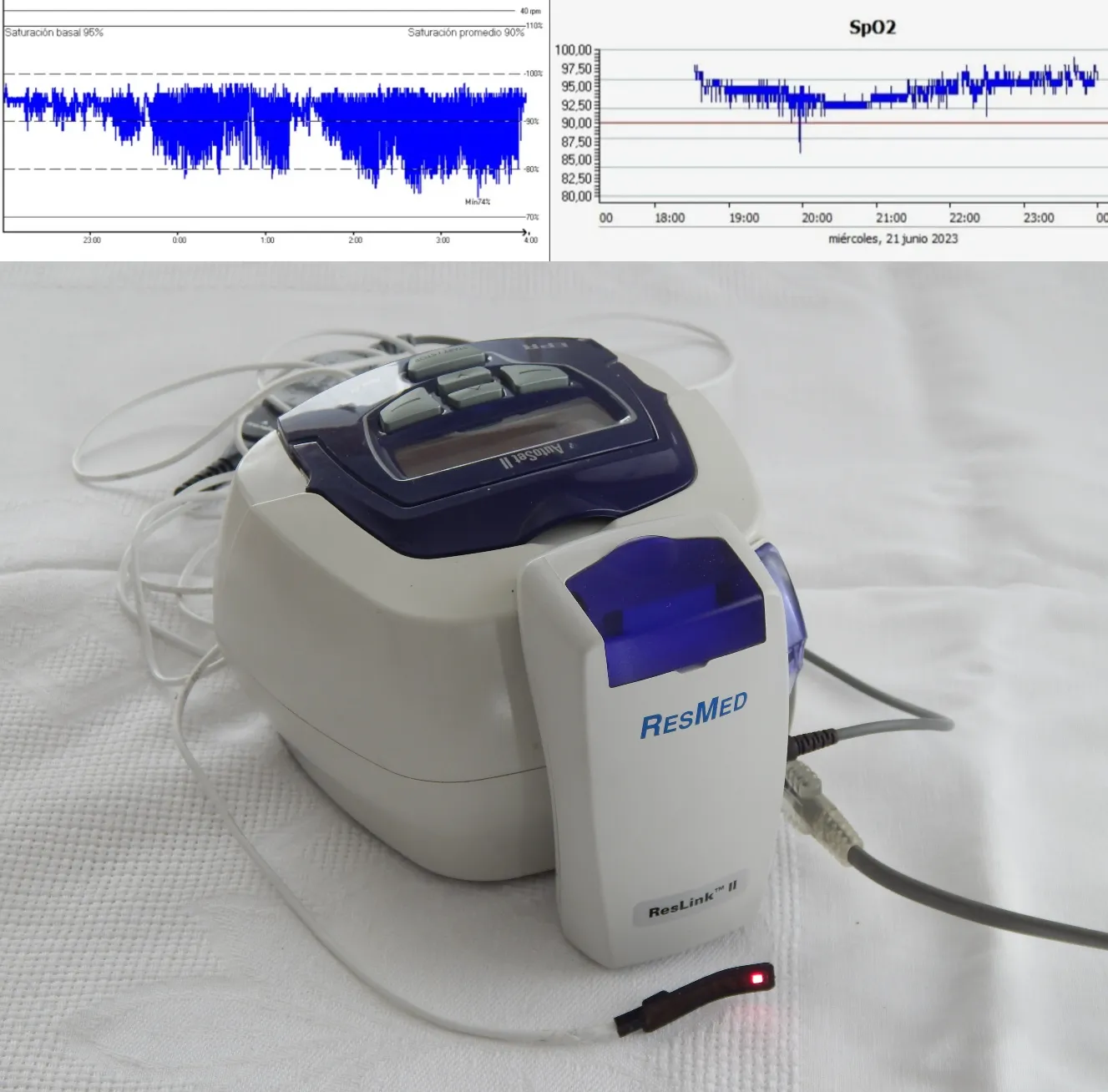 cpap automatico con oximetria y curva