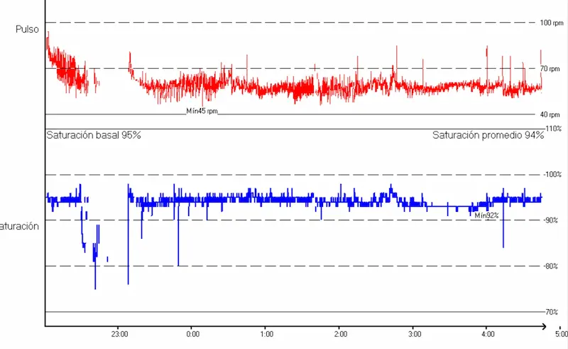 oximetria en paciente con sahos usando cpap