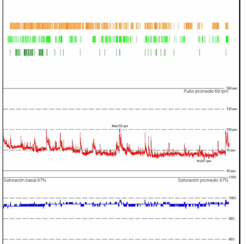 informe de un estudio de sueño con apnea link