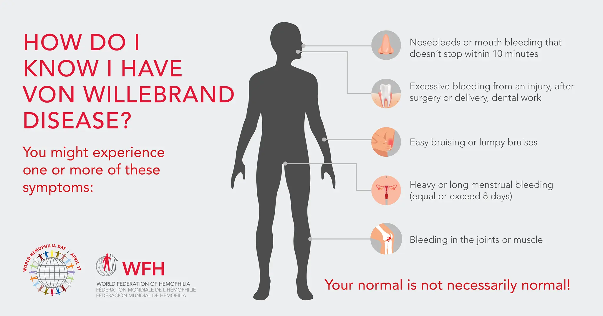 infografia de enfermedad de Von Willebrand